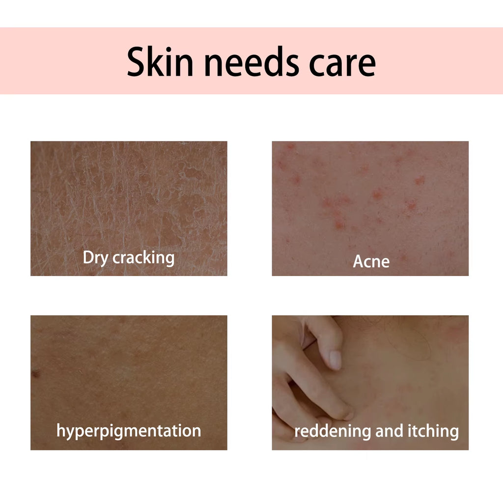 Body Massage Oil Relax Muscles Improve Dryness Relieve Smooth Deeply Moisturize Keep Tightening Romantic SPA Body Essential Oil