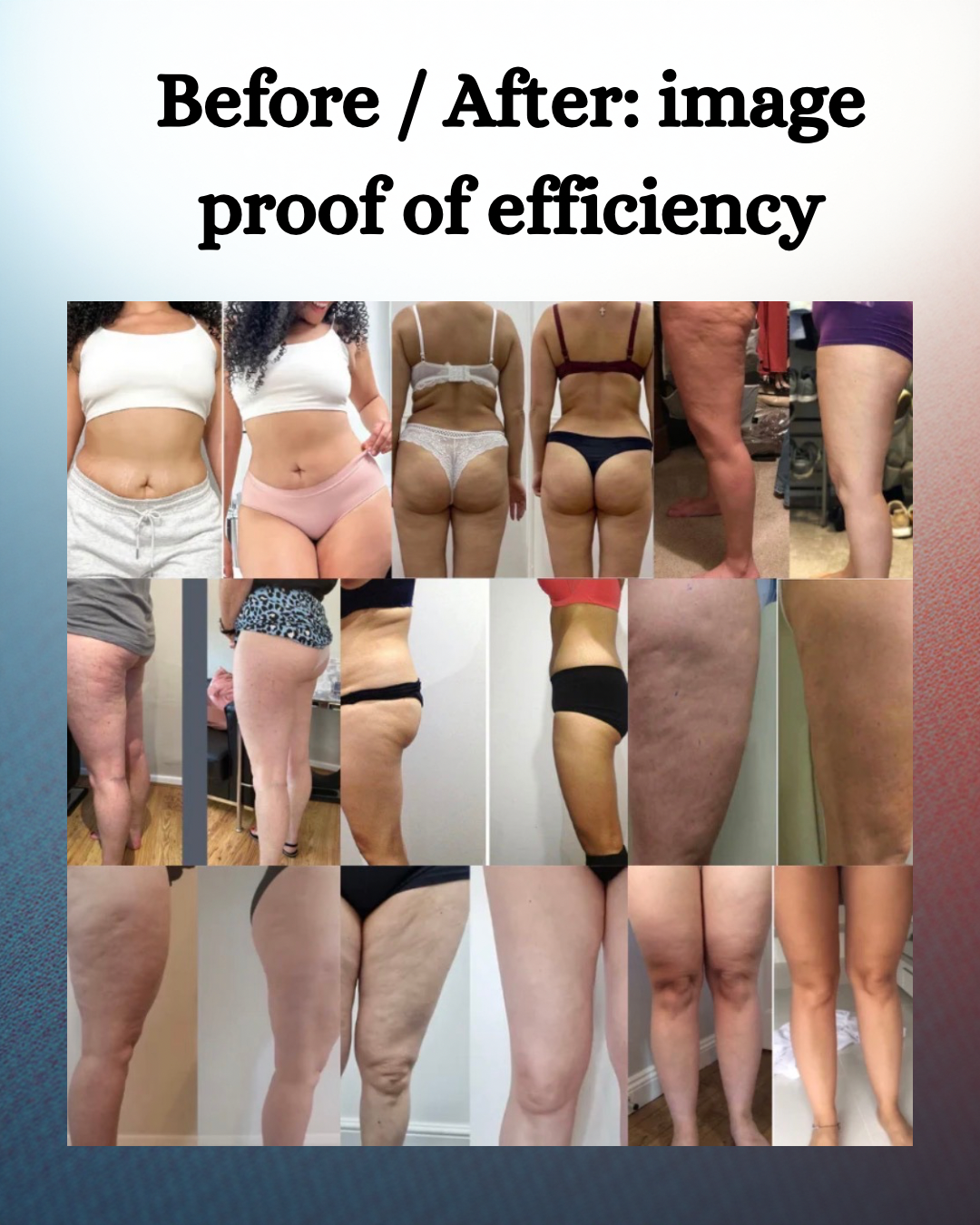 12 Levels Electric Cupping Massager Vacuum Suction Cup Guasha anti Cellulite Scraping Heating Body Slimming Massage Therapy 